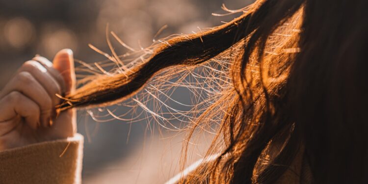 cabelo-fica-oleoso-poucas-horas-depois-da-lavagem-o-err-750x375.jpg