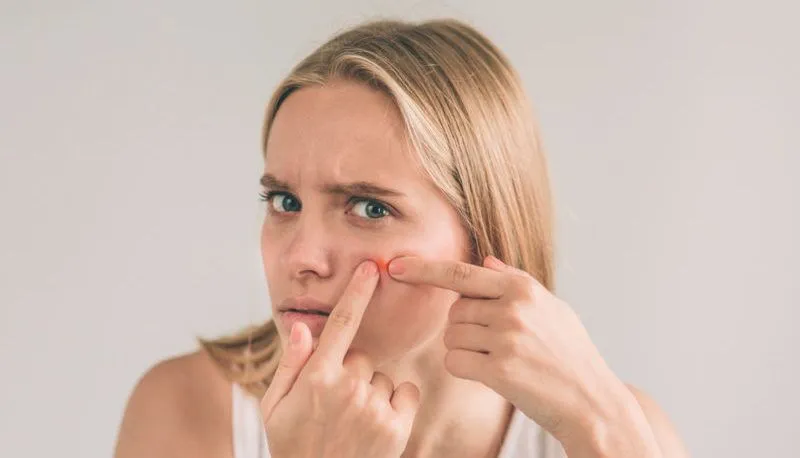 Woman-pressing-a-pimple-e1565678301815.webp